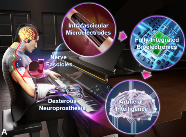 开发板能这么用?美国学者用Jetson Nano支持假肢,控制每一根手指