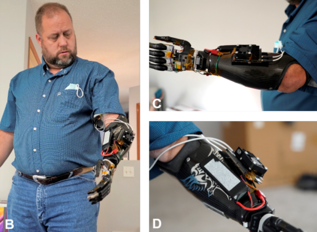 开发板能这么用?美国学者用Jetson Nano支持假肢,控制每一根手指