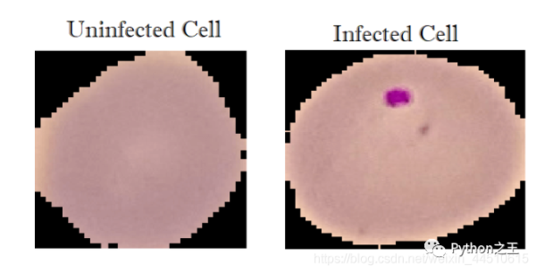 教你使用TensorFlow2判断细胞图像是否感染